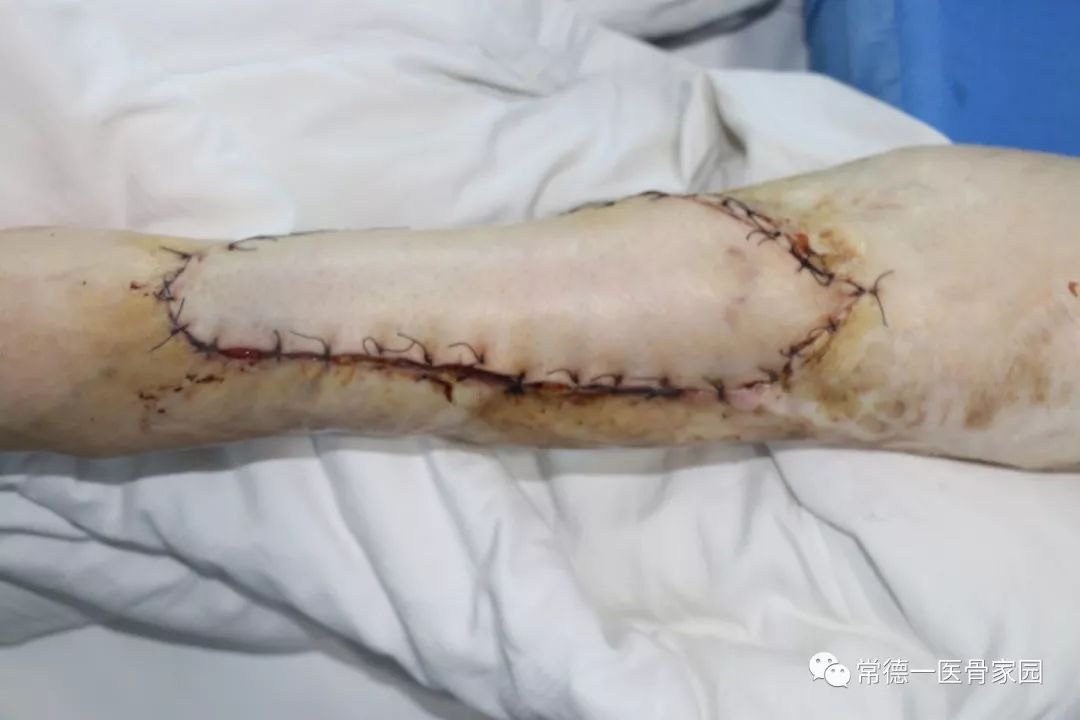 ayx官网_2018年我国121个城市空气质量达标